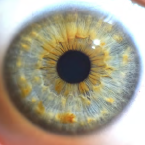 Iridologia Glossário temático PICS Ministério da Saúde 1ª ed 2018..png