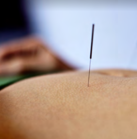 Acupuntura Glossário temático PICS Ministério da Saíde 1ª ed 2018